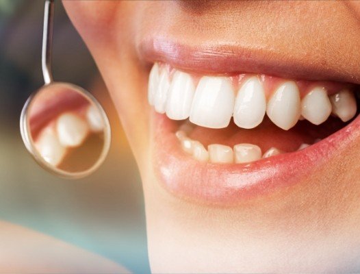 Dentit examining patient's healthy smile after periodontal therapy